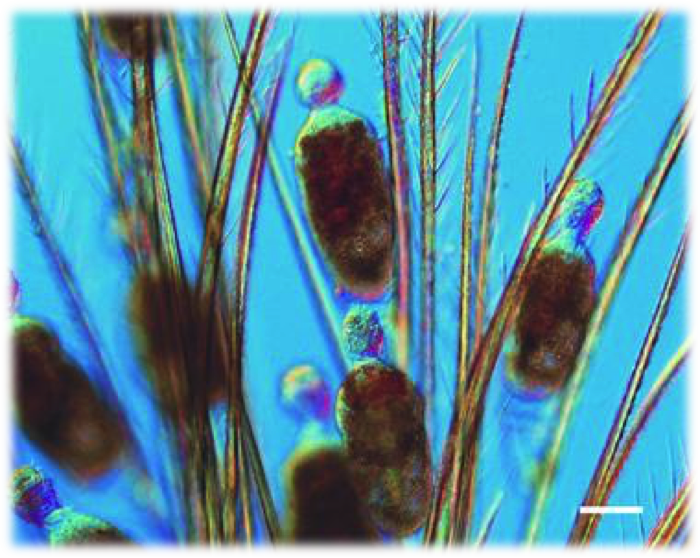 Cycliophora (http://www.leica-microsystems.com/science-lab/in-the-footsteps-of-linnaeus-microscopic-imaging-in-marine-biodiversity-research/)